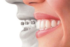 Cosmetic Dentistry